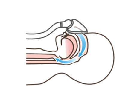 ̵̲Ƶ۾ɸCPAPŤĤ餤˺㲿夹Ф褤?